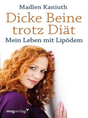 cover image of Dicke Beine trotz Diät